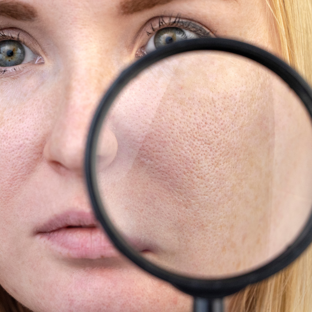 How to Minimize Pores Naturally