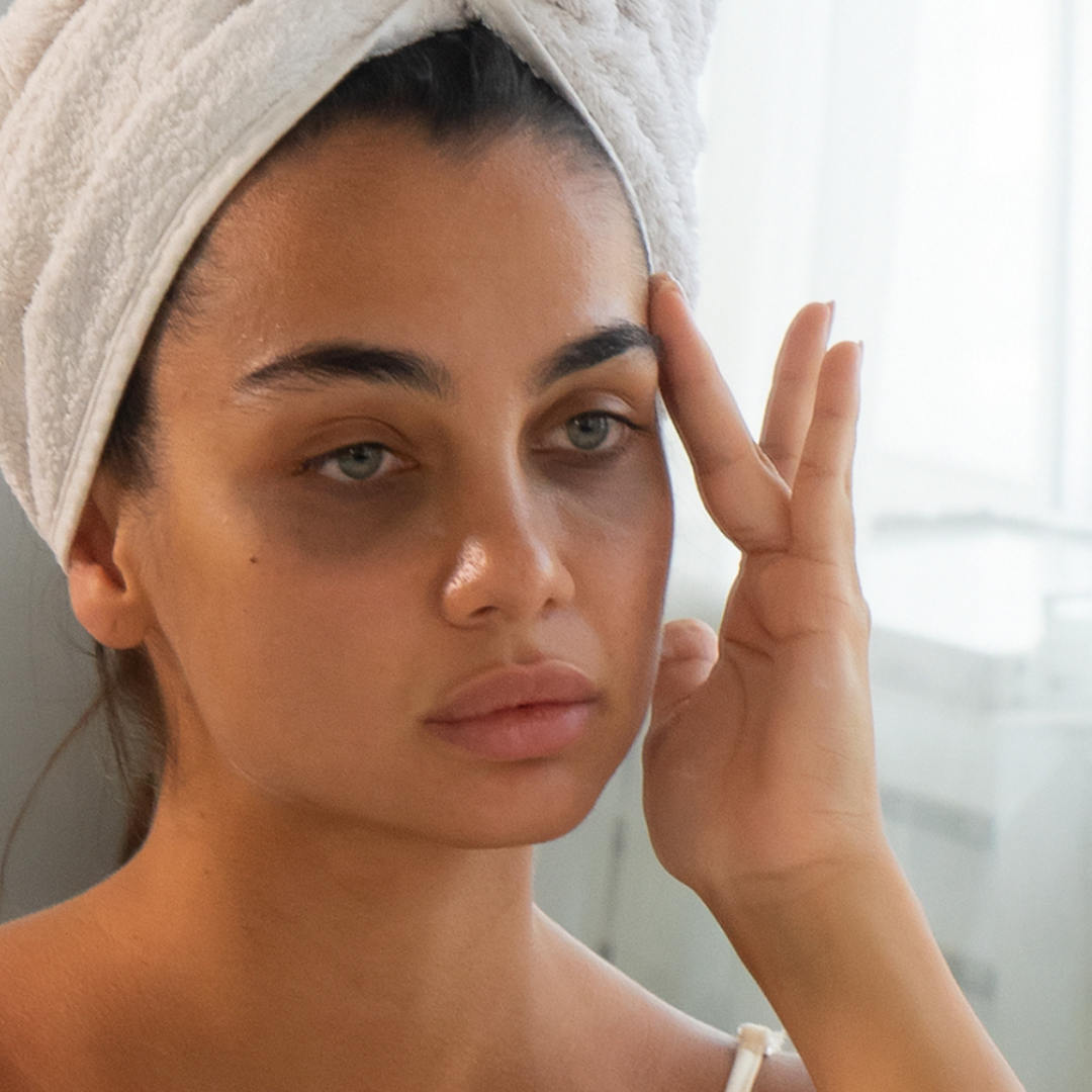 How To Get Rid Of Dark Circles & Under-Eye Bags