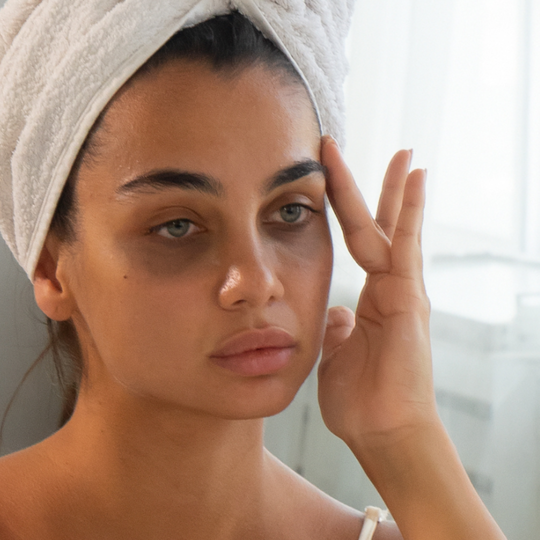 How to Get Rid of Dark Circles, Wrinkles & Bags Under Eyes